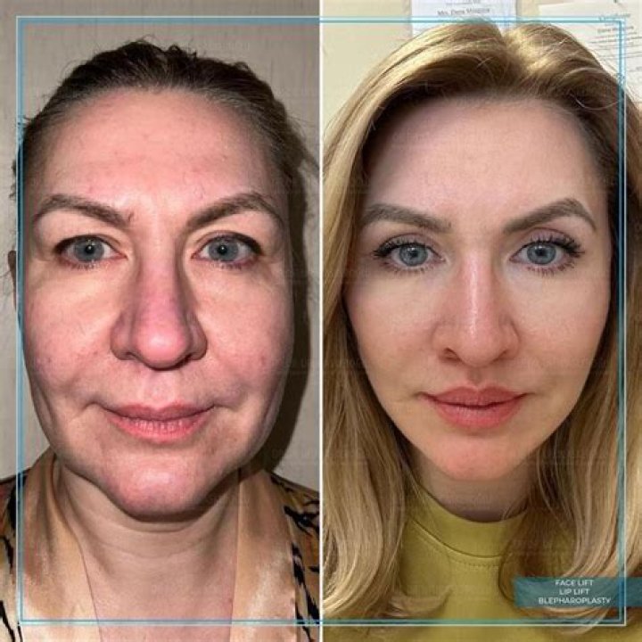 Izi Net Worth - How Much Does Izi Make?