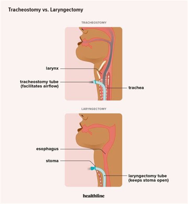 Lary Over Net Worth - How Much Does Lary Over Make?